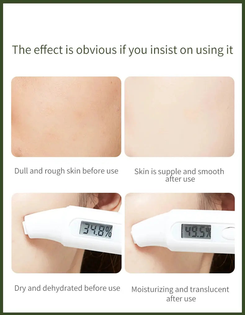 OEM White Truffle Yeast Seven Pieces Skincare Kit Anti-Wrinkle Lightening Firm Skin Collagen Natural Skin Care Set Gift Box