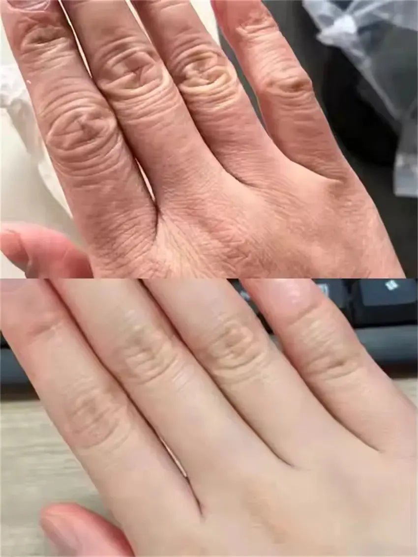 Advanced Hand Care Beauty Machine for Smooth Youthful Hands Professional Skincare Device