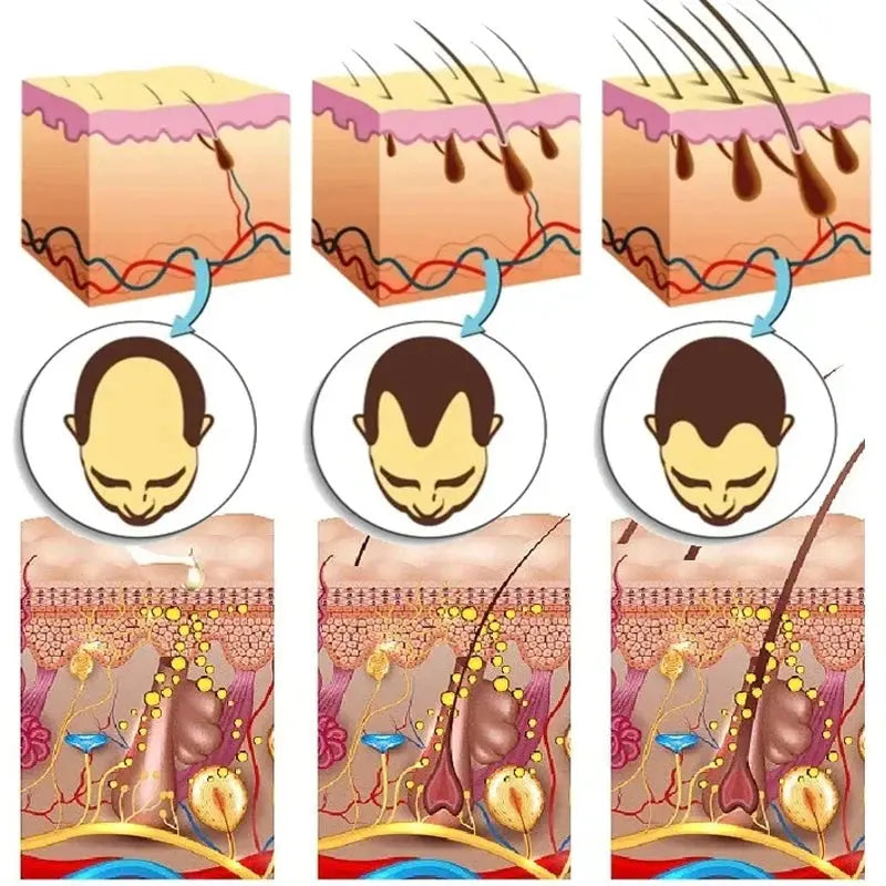 7 Days Ginger Hair Growth Serum Fast Promote Hair Regrowth Products Anti Hair Loss Repair Scalp Baldness Nourish Hair Root Care Avivanastore