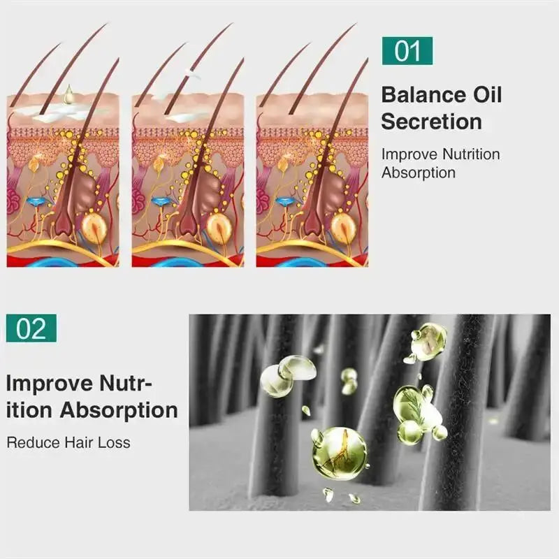 7 Days Ginger Hair Growth Serum Fast Promote Hair Regrowth Products Anti Hair Loss Repair Scalp Baldness Nourish Hair Root Care Avivanastore