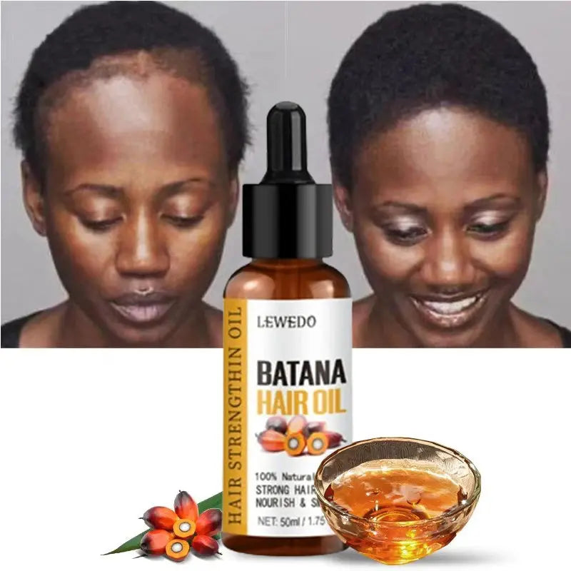 Lewedo Naturals Batana Oil Fast Hair Growth for Men Women Pure Batana Oil Nourish Shiny Hair Healthy Hair Care Anti Hair Loss Avivanastore