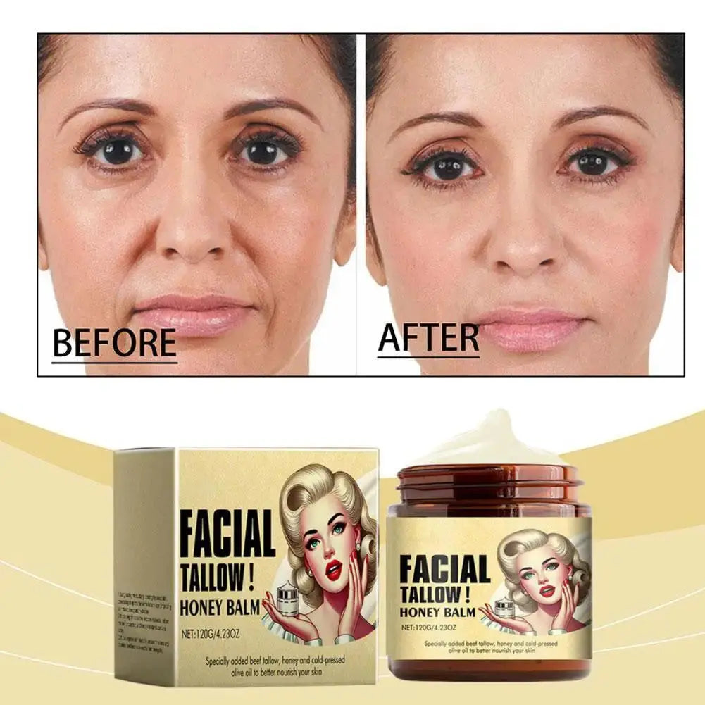 120g Whipped Beef Tallow And Honey Balm Moisturizing Beef Tallow Face Cream Body Lotion Grass Fed Grass Finished Face Cream Care Avivanastore