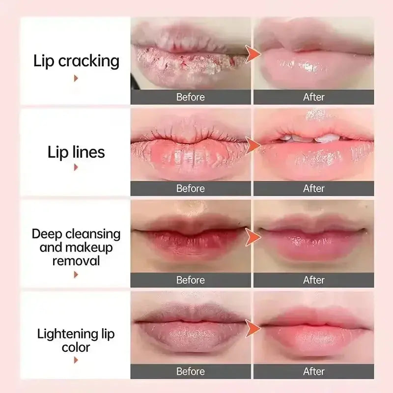 Fast Lightening Pink Mouth Lips Serum Bleaching Permanent Remove Dark Smoke Lips Lip Balm Moisturize Gloss Lipstick Lip Serum Avivanastore